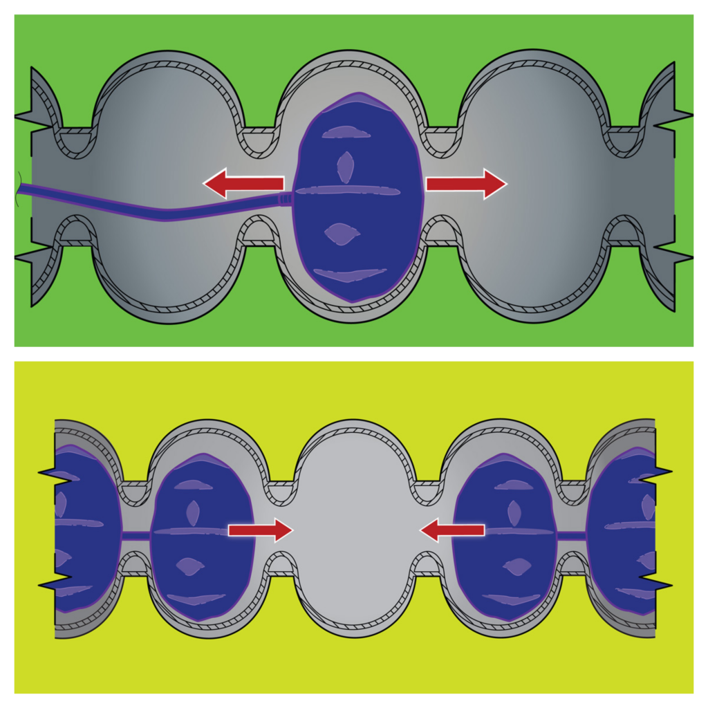 Balloon Tuning | Partnerships and Technology Transfer